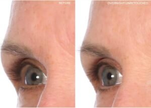 top 6 beauty products retinol vitamin c foot mask body buffer facial serum facelift patches