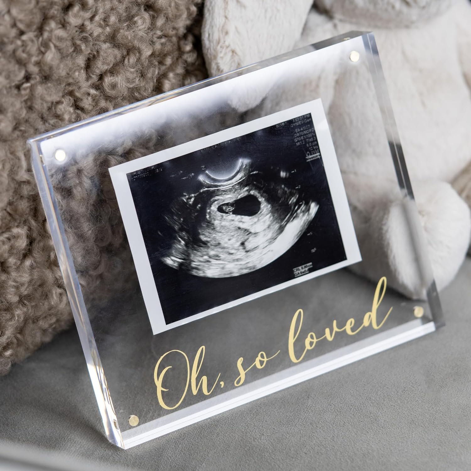 Ultrasound Picture Frames - Newborn Photo  Sonogram Picture Frame - Modern Custom Baby Sonogram Frame - Early Pregnancy Must Haves First Trimester Pregnancy Essentials Ultrasound Frame - Baby Sonogram Picture Frame - Ultrasound Photo Frame